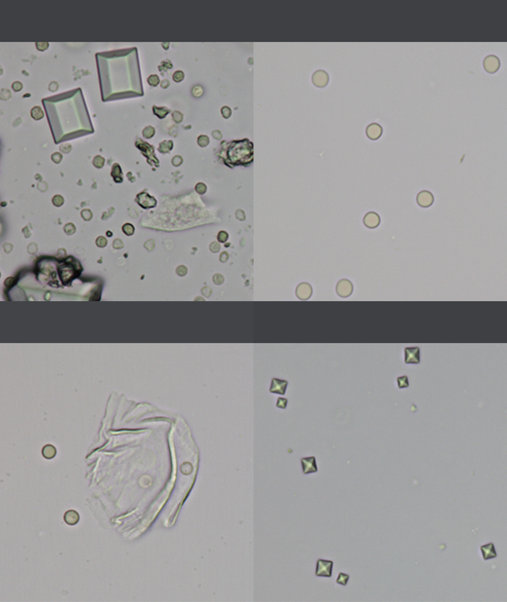 Urine image